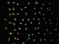 Galaxy Evolution